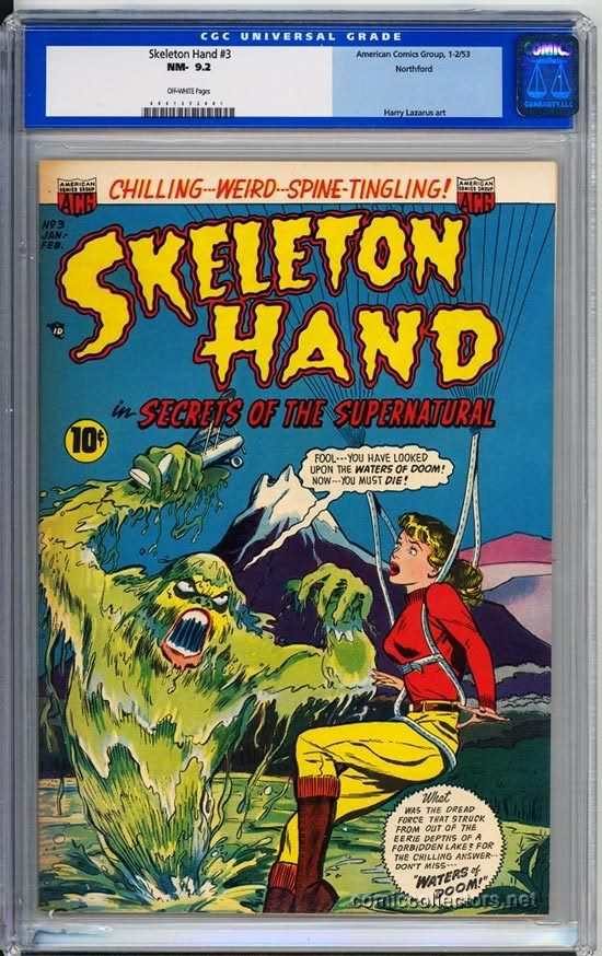 SkeletonHand3CGC92.jpg